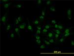 TOE1 Antibody in Immunocytochemistry (ICC/IF)