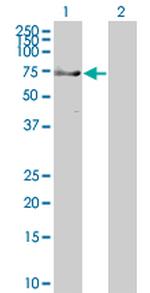 TRIM9 Antibody in Western Blot (WB)