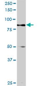 TRIM9 Antibody in Western Blot (WB)