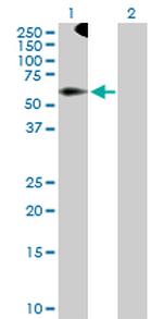 TRIM9 Antibody in Western Blot (WB)