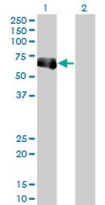 TRIM9 Antibody in Western Blot (WB)