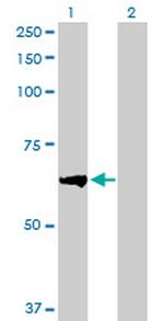 BTBD9 Antibody in Western Blot (WB)