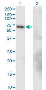 BTBD9 Antibody in Western Blot (WB)