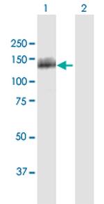 OSBPL5 Antibody in Western Blot (WB)