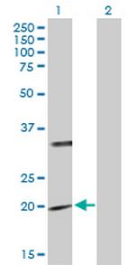 PTPMT1 Antibody in Western Blot (WB)