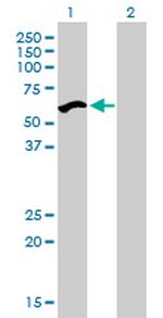 UHRF2 Antibody in Western Blot (WB)