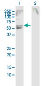 SLC22A12 Antibody in Western Blot (WB)