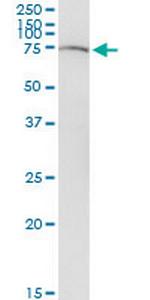 SLC22A12 Antibody in Western Blot (WB)