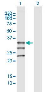 MOGAT1 Antibody in Western Blot (WB)