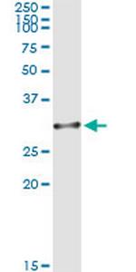 OLIG1 Antibody in Immunoprecipitation (IP)