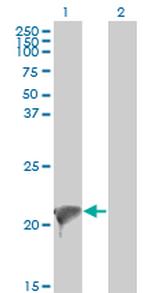 TWIST2 Antibody in Western Blot (WB)