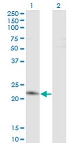 TWIST2 Antibody in Western Blot (WB)