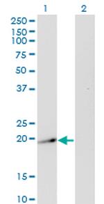 TWIST2 Antibody in Western Blot (WB)