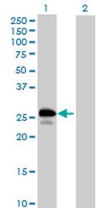 UBE2J2 Antibody in Western Blot (WB)