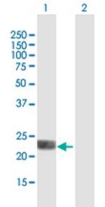 LOH12CR1 Antibody in Western Blot (WB)