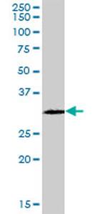 GSTO2 Antibody in Western Blot (WB)