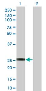 GSTO2 Antibody in Western Blot (WB)