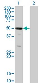 SOCS4 Antibody in Western Blot (WB)