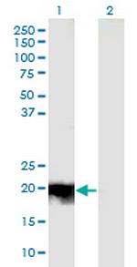 JDP2 Antibody in Western Blot (WB)