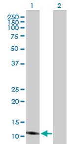 ISCA2 Antibody in Western Blot (WB)