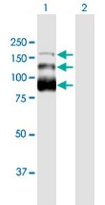 ZC3H18 Antibody in Western Blot (WB)