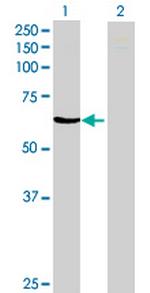 ZNF543 Antibody in Western Blot (WB)