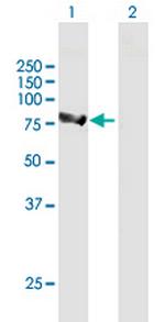 ALDH16A1 Antibody in Western Blot (WB)