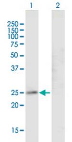 GJB4 Antibody in Western Blot (WB)