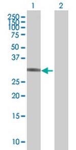 UHMK1 Antibody in Western Blot (WB)