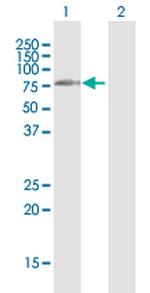 DIS3L2 Antibody in Western Blot (WB)