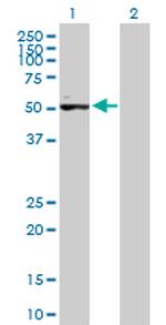 ACVR1C Antibody in Western Blot (WB)