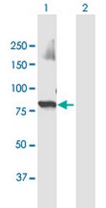 UBR3 Antibody in Western Blot (WB)