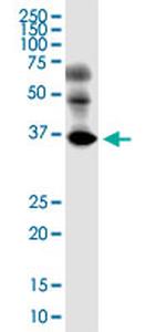 EMB Antibody in Western Blot (WB)