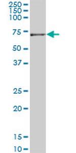 JMY Antibody in Western Blot (WB)