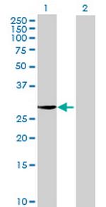 PACRG Antibody in Western Blot (WB)