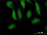 MTPN Antibody in Immunocytochemistry (ICC/IF)