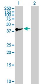 SPAG4L Antibody in Western Blot (WB)