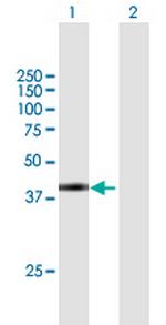 SPAG4L Antibody in Western Blot (WB)