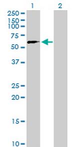 SUHW2 Antibody in Western Blot (WB)