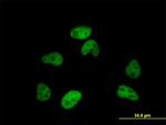 SFRS12 Antibody in Immunocytochemistry (ICC/IF)