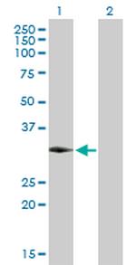 GSC Antibody in Western Blot (WB)