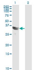 GSC Antibody in Western Blot (WB)