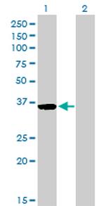 GSC Antibody in Western Blot (WB)