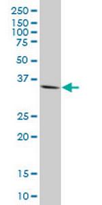 GSC Antibody in Western Blot (WB)