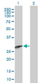 CCBE1 Antibody in Western Blot (WB)