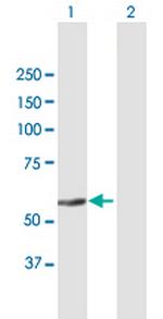 ZNF582 Antibody in Western Blot (WB)