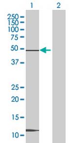 CREB3L4 Antibody in Western Blot (WB)