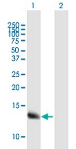 WFDC5 Antibody in Western Blot (WB)