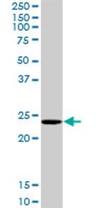 COMMD1 Antibody in Western Blot (WB)