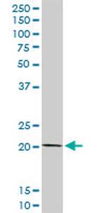 COMMD1 Antibody in Western Blot (WB)